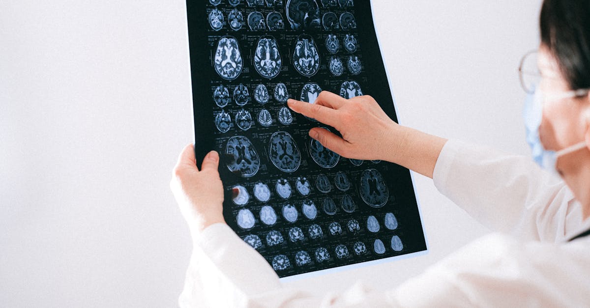 découvrez la maladie de charcot, un trouble neurodégénératif complexe qui affecte les muscles et la coordination. apprenez-en plus sur ses symptômes, son diagnostic et les options de traitement dans cet article informatif.