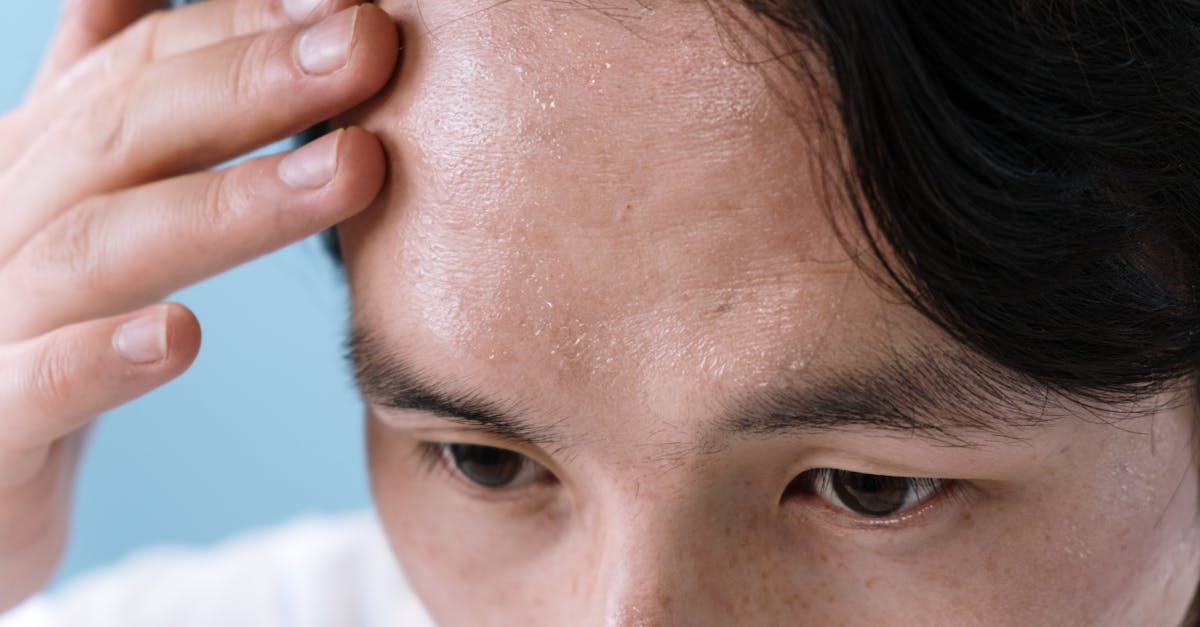 découvrez la maladie de charcot, une pathologie neurologique rare qui affecte le système nerveux et provoque une dégradation progressive de la moelle épinière. informez-vous sur les symptômes, le diagnostic et les options de traitement disponibles.