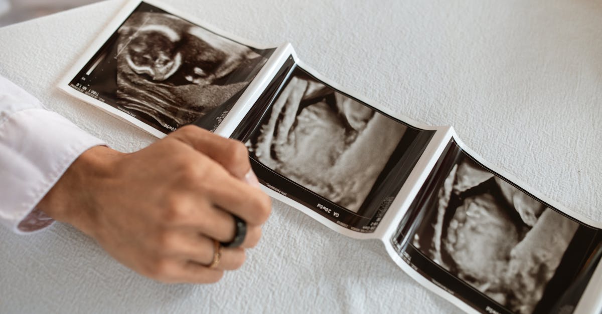 découvrez tout sur l’ovulation : son rôle dans le cycle menstruel, comment la détecter, les signes à surveiller et les conseils pour optimiser vos chances de grossesse.